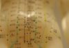 Acupuncture can be a wonderful tool for preventing number of diseases